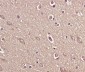 Anti-BDNF Rabbit Monoclonal Antibody